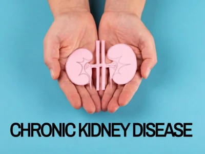 Chronic-Kidney-Disease Chronic-Kidney-Disease