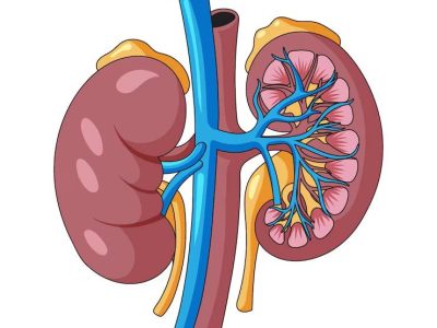kidneystone kidneystone